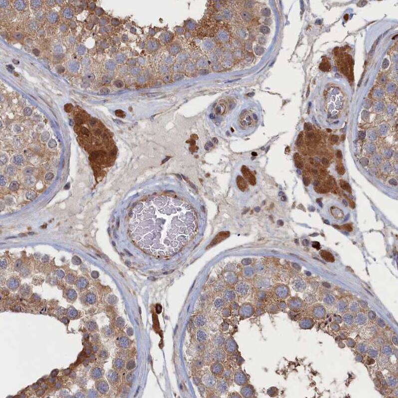 DOC1 Antibody - BSA Free Immunohistochemistry-Paraffin: DOC1 Antibody - BSA Free [NBP1-84064]