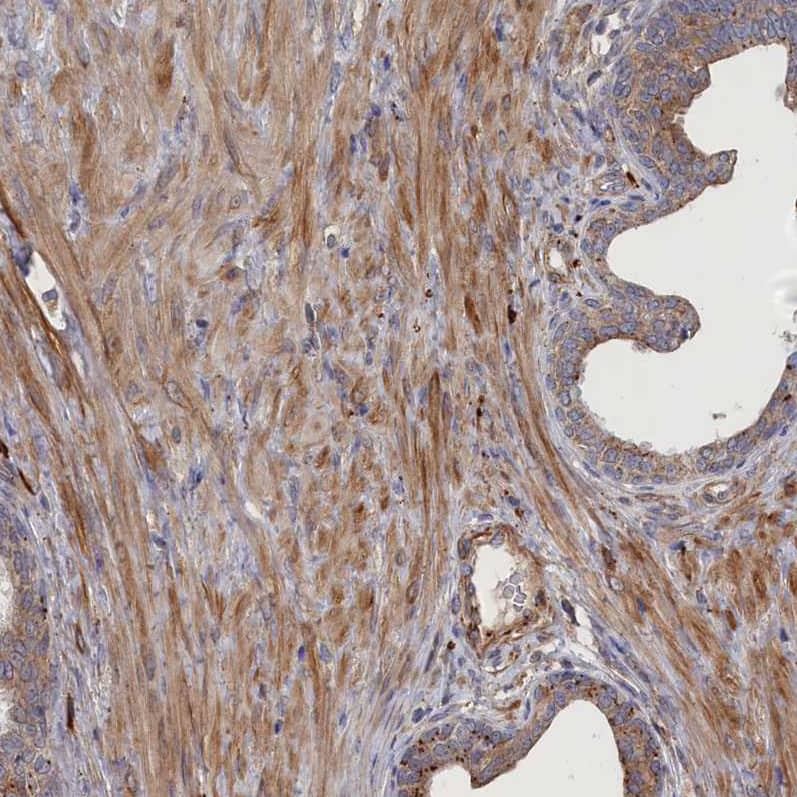 DOC1 Antibody - BSA Free Immunohistochemistry-Paraffin: DOC1 Antibody - BSA Free [NBP1-84064]
