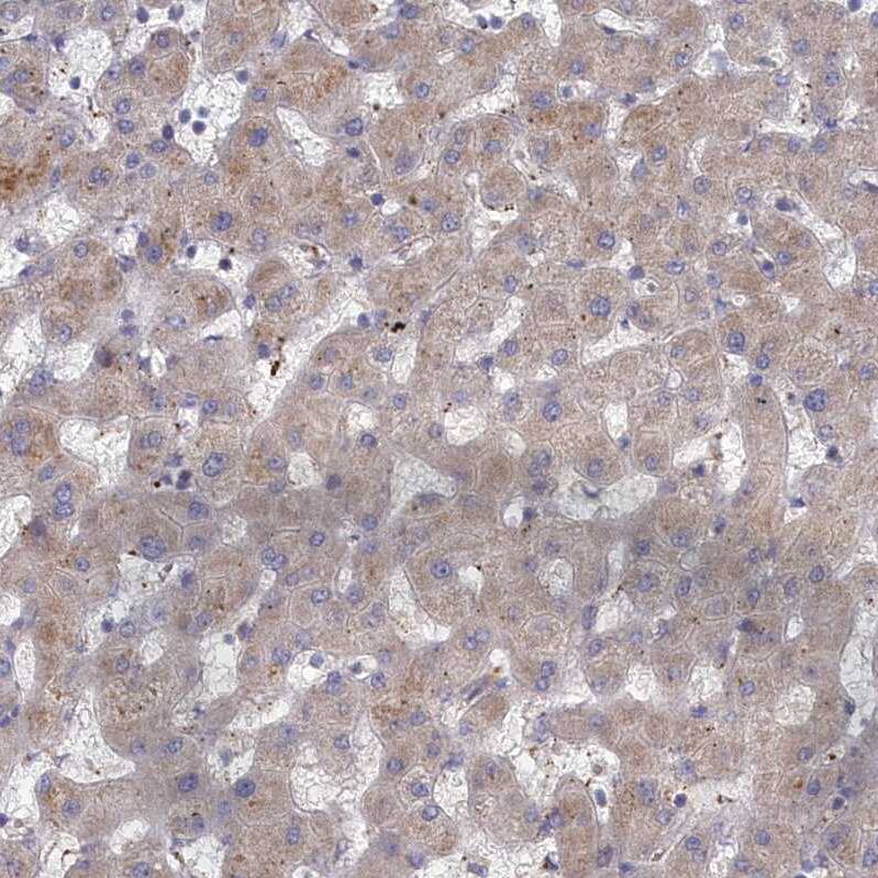 DOC1 Antibody - BSA Free Immunohistochemistry-Paraffin: DOC1 Antibody - BSA Free [NBP1-84064]