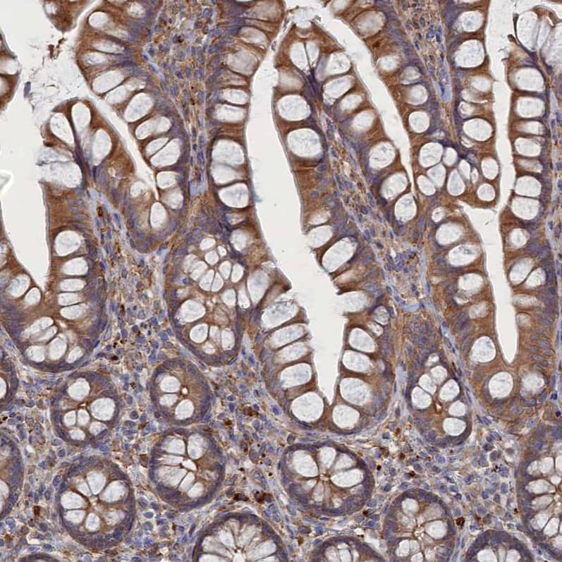 DOC1 Antibody - BSA Free Immunohistochemistry-Paraffin: DOC1 Antibody - BSA Free [NBP1-84064]