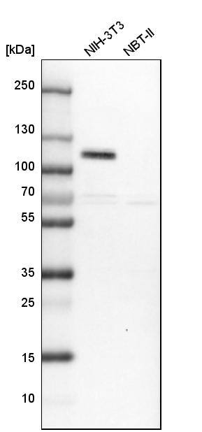 DOC1 Antibody - BSA Free Western Blot: DOC1 Antibody - BSA Free [NBP1-84064]