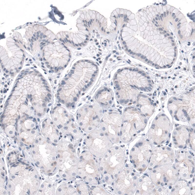 DMRT1 Antibody - BSA Free Immunohistochemistry-Paraffin: DMRT1 Antibody - BSA Free [NBP1-84071]