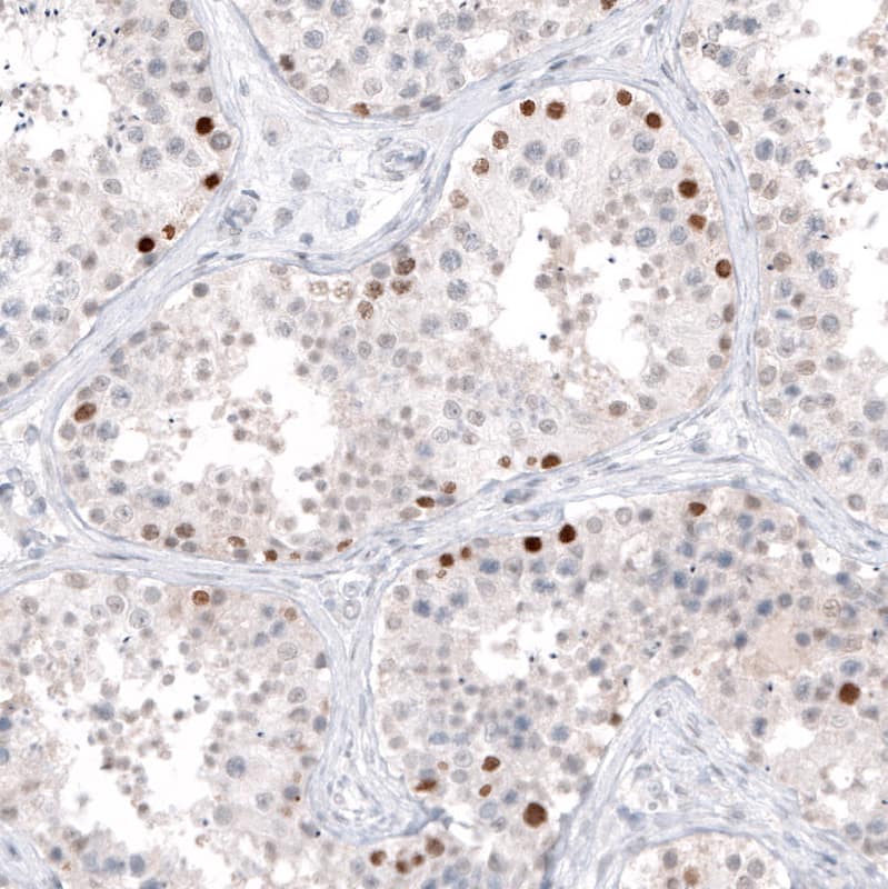 DMRT1 Antibody - BSA Free Immunohistochemistry-Paraffin: DMRT1 Antibody - BSA Free [NBP1-84071]