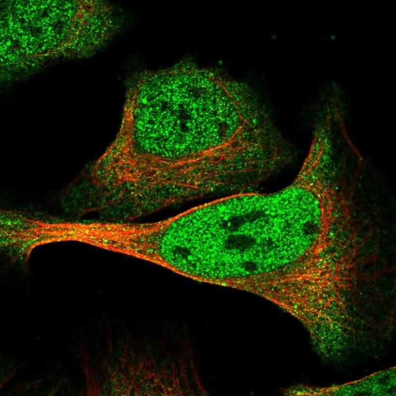 DMTF1 Antibody - BSA Free Immunocytochemistry/ Immunofluorescence: DMTF1 Antibody [NBP1-84073]
