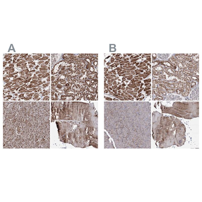 PDHX Antibody - BSA Free Immunohistochemistry-Paraffin: PDHX Antibody - BSA Free [NBP1-84079]