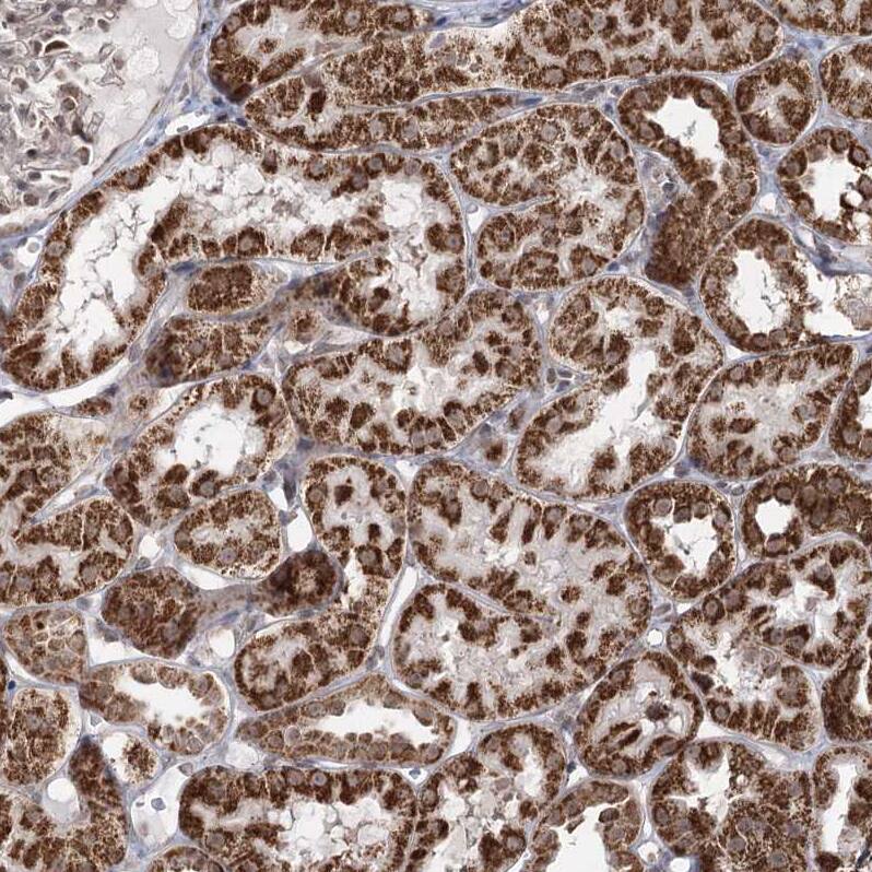 PDHX Antibody - BSA Free Immunohistochemistry-Paraffin: PDHX Antibody - BSA Free [NBP1-84079]