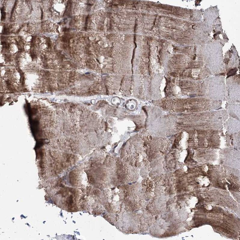 PDHX Antibody - BSA Free Immunohistochemistry-Paraffin: PDHX Antibody - BSA Free [NBP1-84079]