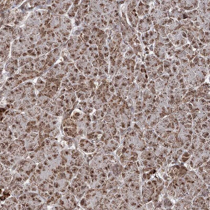 PDHX Antibody - BSA Free Immunohistochemistry-Paraffin: PDHX Antibody - BSA Free [NBP1-84079]