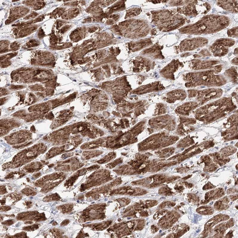 PDHX Antibody - BSA Free Immunohistochemistry-Paraffin: PDHX Antibody - BSA Free [NBP1-84079]