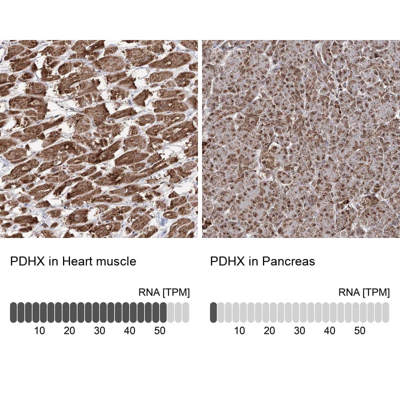 PDHX Antibody - BSA Free Immunohistochemistry-Paraffin: PDHX Antibody - BSA Free [NBP1-84079]