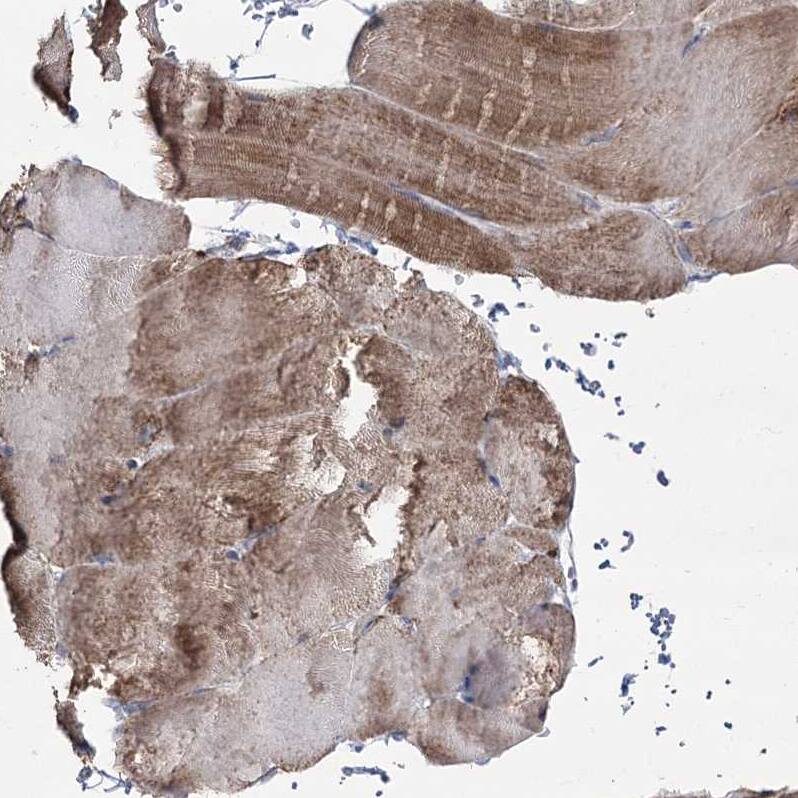 PDHX Antibody - BSA Free Immunohistochemistry-Paraffin: PDHX Antibody - BSA Free [NBP1-84080]