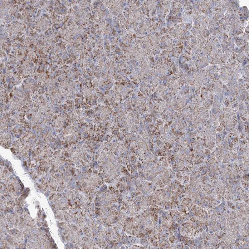 PDHX Antibody - BSA Free Immunohistochemistry-Paraffin: PDHX Antibody - BSA Free [NBP1-84080]