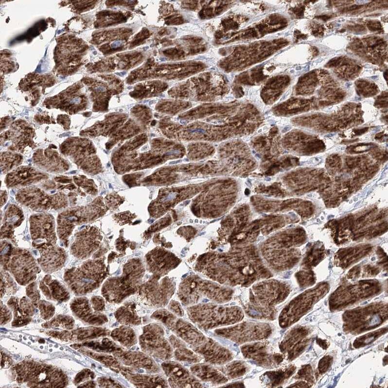 PDHX Antibody - BSA Free Immunohistochemistry-Paraffin: PDHX Antibody - BSA Free [NBP1-84080]