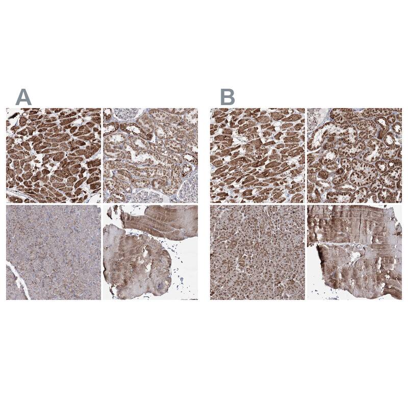PDHX Antibody - BSA Free Immunohistochemistry-Paraffin: PDHX Antibody - BSA Free [NBP1-84080]