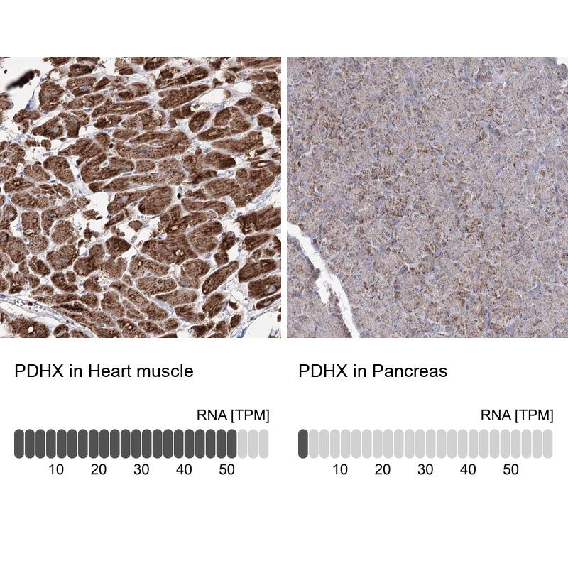 PDHX Antibody - BSA Free Immunohistochemistry-Paraffin: PDHX Antibody - BSA Free [NBP1-84080]