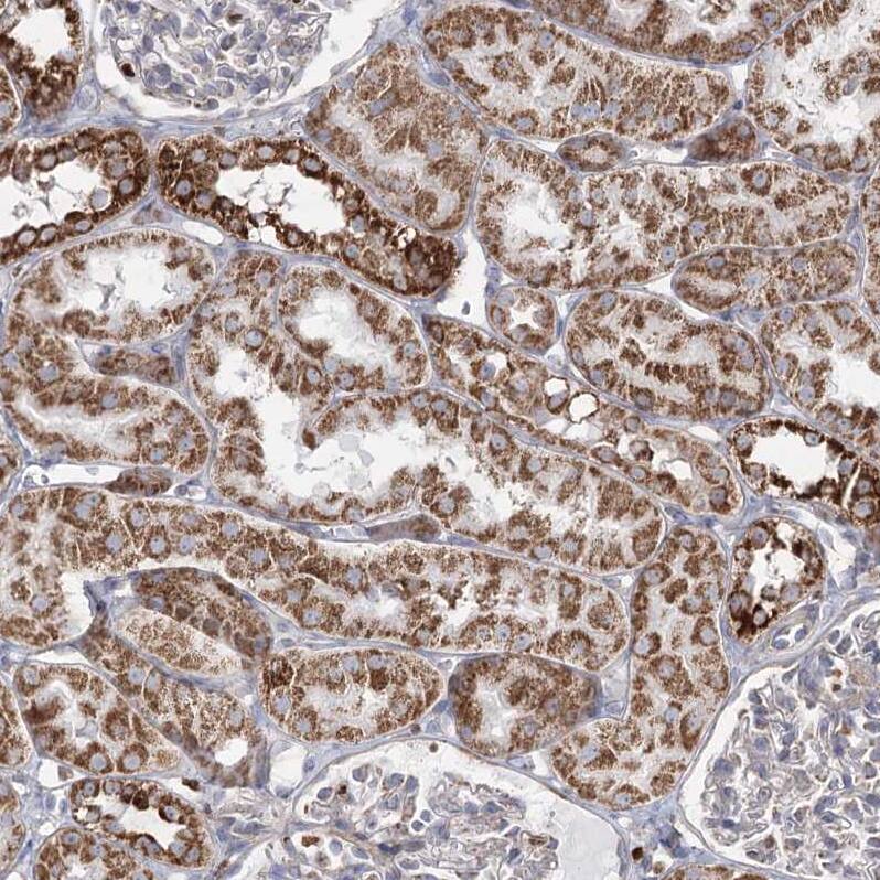PDHX Antibody - BSA Free Immunohistochemistry-Paraffin: PDHX Antibody - BSA Free [NBP1-84080]