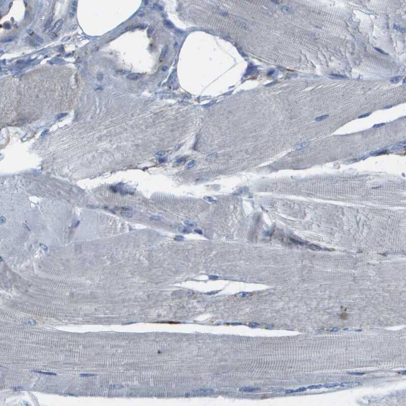 QSOX2 Antibody - BSA Free Immunohistochemistry-Paraffin: QSOX2 Antibody - BSA Free [NBP1-84094]