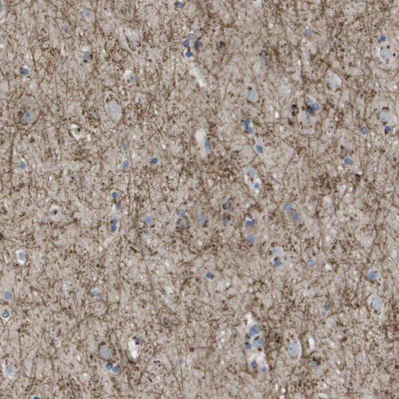 QSOX2 Antibody - BSA Free Immunohistochemistry-Paraffin: QSOX2 Antibody - BSA Free [NBP1-84094]