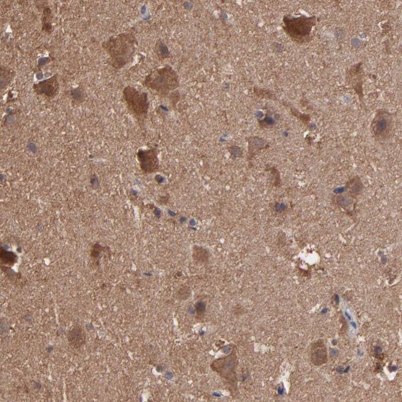 TANGO2 Antibody - BSA Free Immunohistochemistry-Paraffin: TANGO2 Antibody - BSA Free [NBP1-84095]