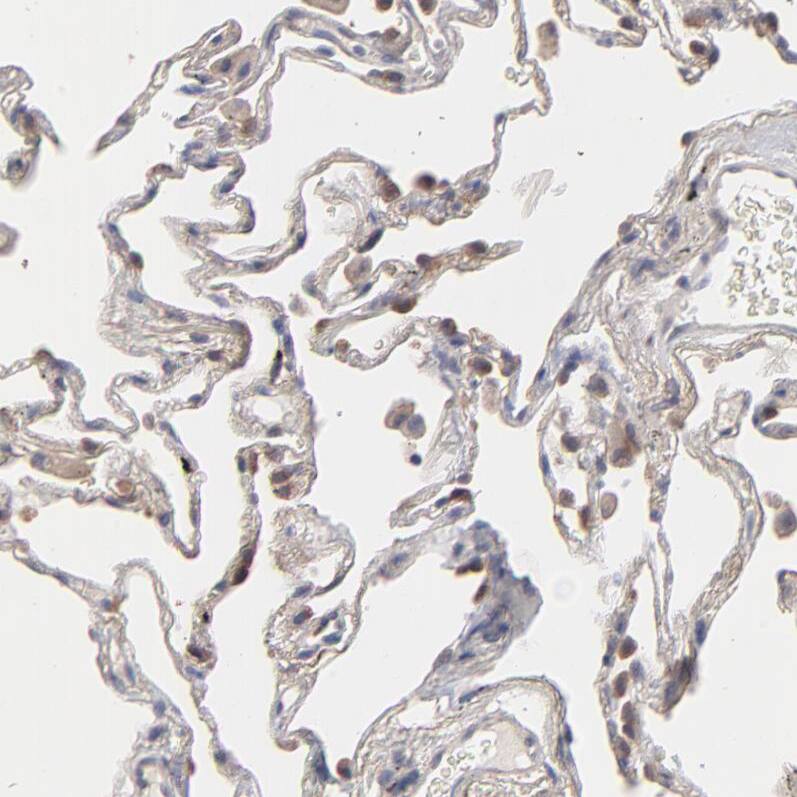 TANGO2 Antibody - BSA Free Immunohistochemistry-Paraffin: TANGO2 Antibody - BSA Free [NBP1-84095]