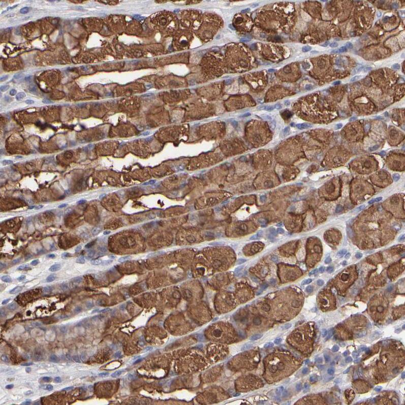 TANGO2 Antibody - BSA Free Immunohistochemistry-Paraffin: TANGO2 Antibody - BSA Free [NBP1-84095]
