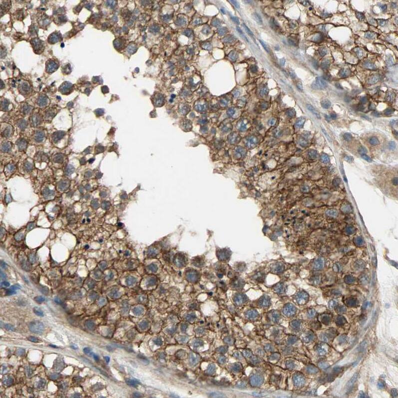SKT Antibody - BSA Free Immunohistochemistry-Paraffin: SKT Antibody [NBP1-84100]
