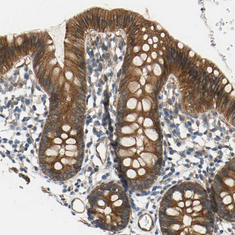 SKT Antibody - BSA Free Immunohistochemistry-Paraffin: SKT Antibody [NBP1-84100]