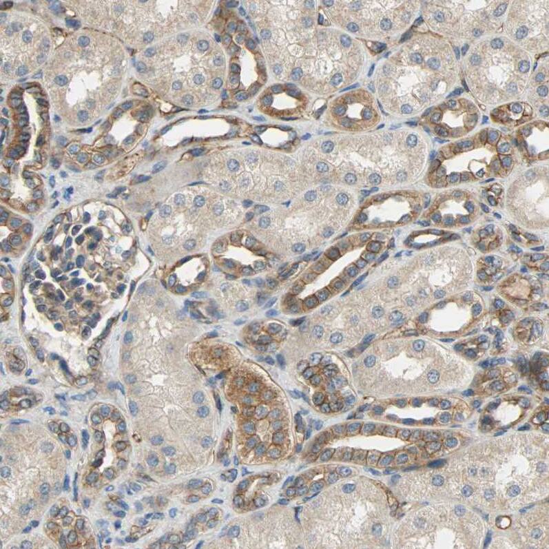 SKT Antibody - BSA Free Immunohistochemistry-Paraffin: SKT Antibody [NBP1-84100]