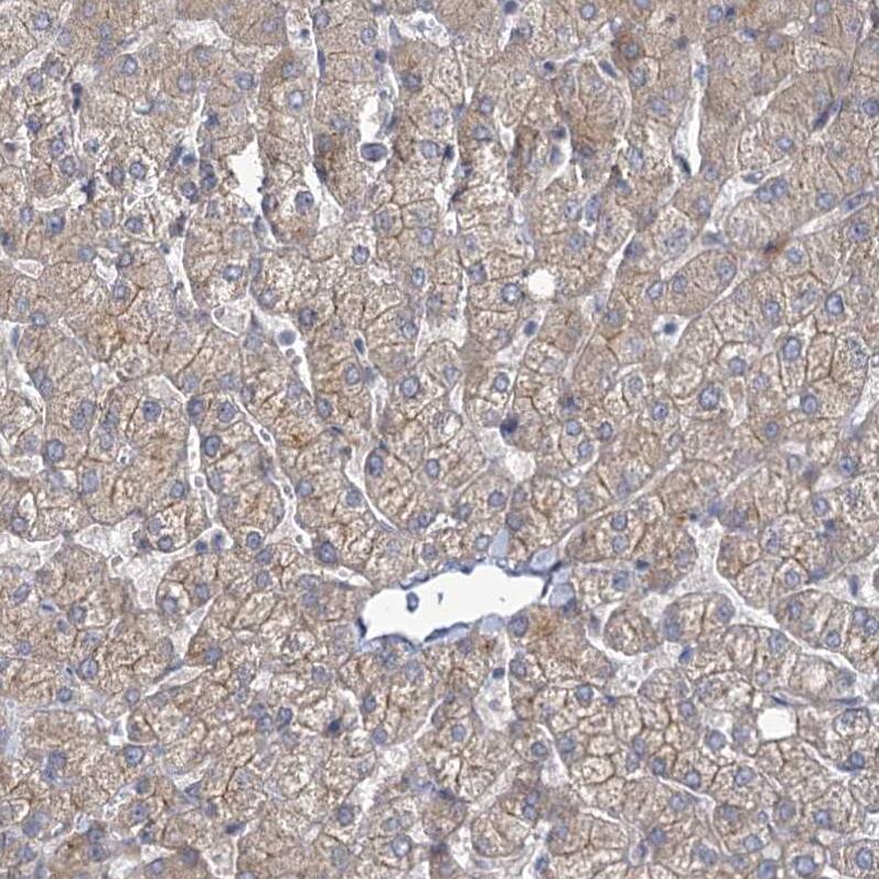 MBLAC2 Antibody - BSA Free Immunohistochemistry-Paraffin: MBLAC2 Antibody - BSA Free [NBP1-84106]
