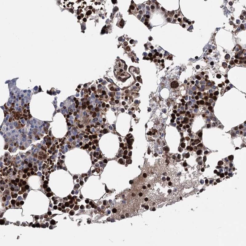 RNF6 Antibody - BSA Free Immunohistochemistry-Paraffin: RNF6 Antibody [NBP1-84107]