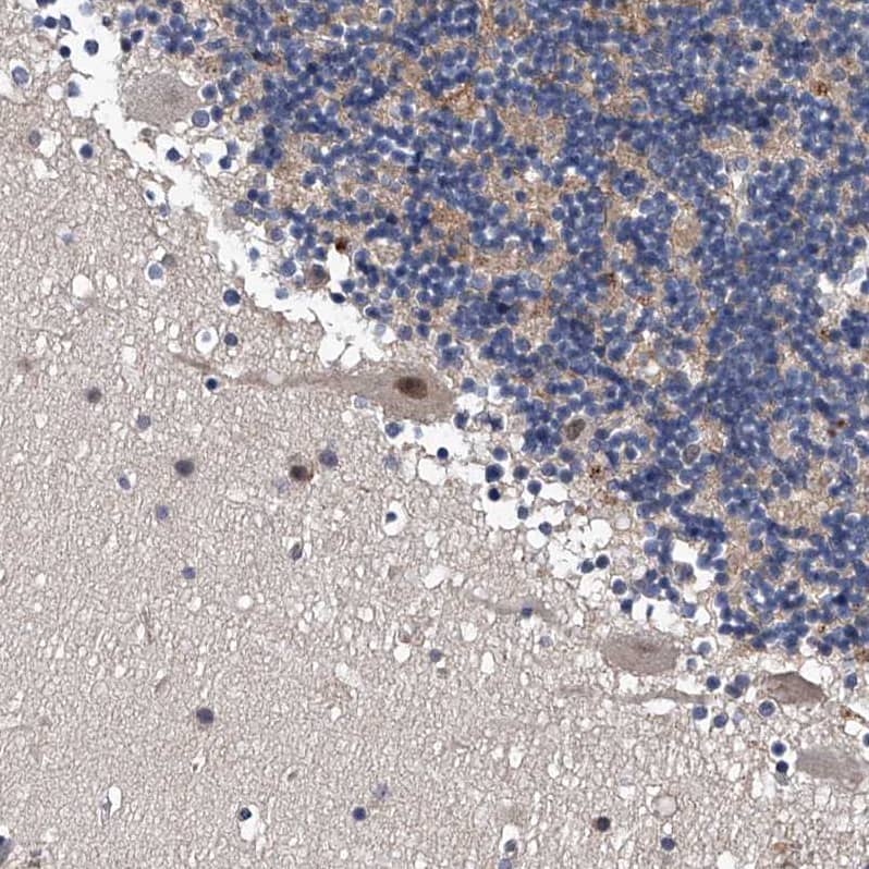 ZNF30 Antibody - BSA Free Immunohistochemistry-Paraffin: ZNF30 Antibody - BSA Free [NBP1-84108]