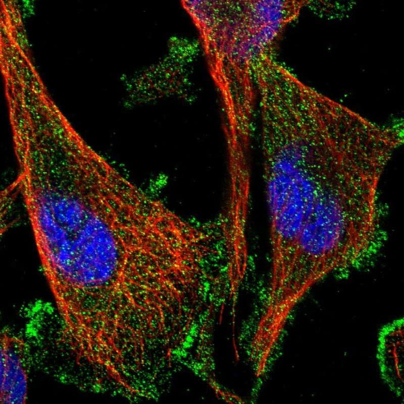 AAK1 Antibody - BSA Free Immunocytochemistry/ Immunofluorescence: AAK1 Antibody [NBP1-84110]