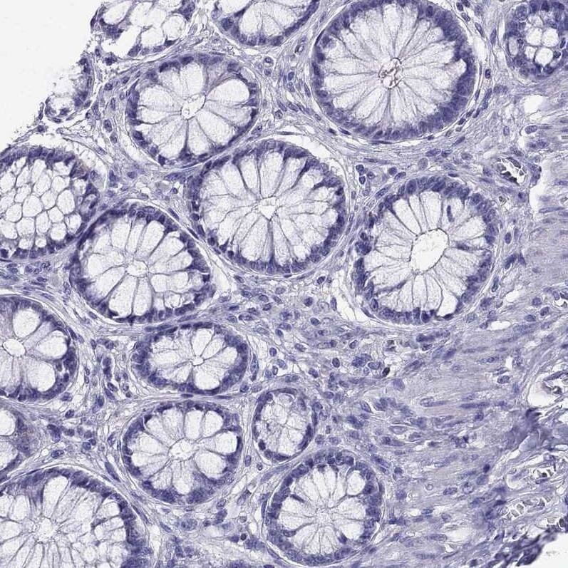 AAK1 Antibody - BSA Free Immunohistochemistry-Paraffin: AAK1 Antibody - BSA Free [NBP1-84110]