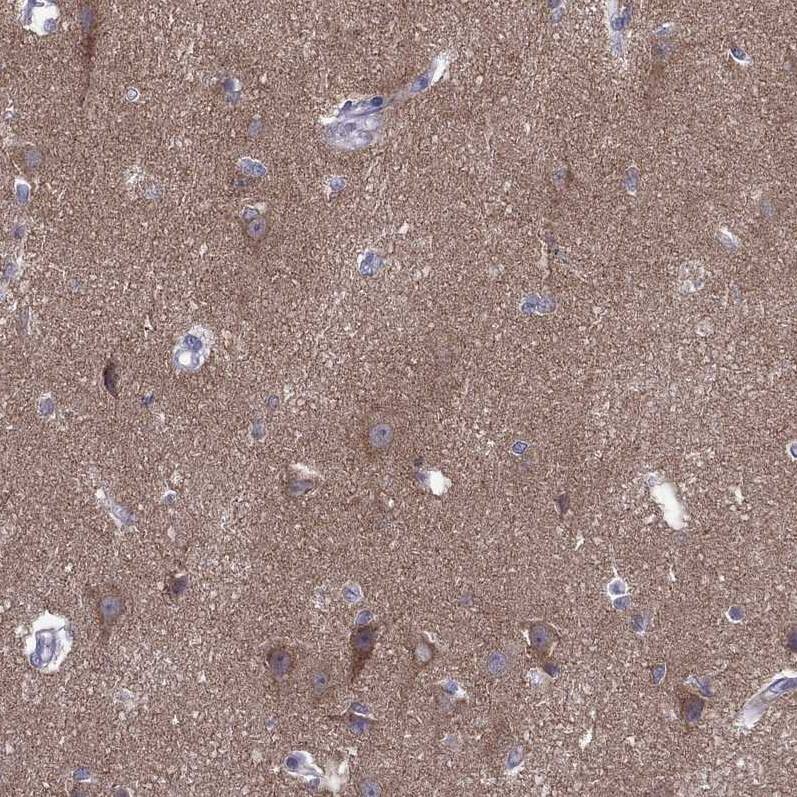 AAK1 Antibody - BSA Free Immunohistochemistry-Paraffin: AAK1 Antibody - BSA Free [NBP1-84110]
