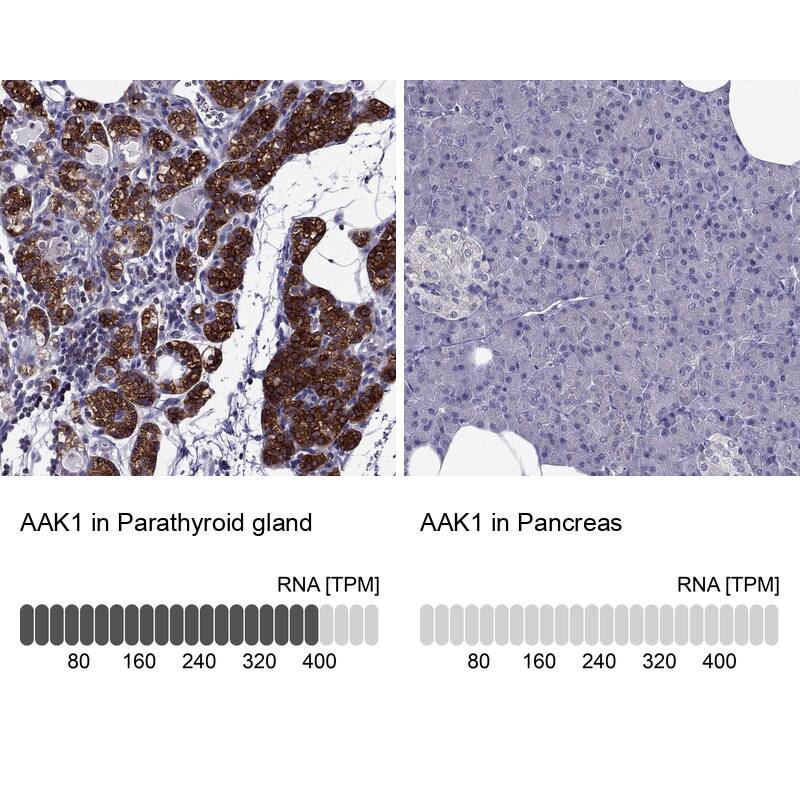 AAK1 Antibody - BSA Free Immunohistochemistry-Paraffin: AAK1 Antibody - BSA Free [NBP1-84110]