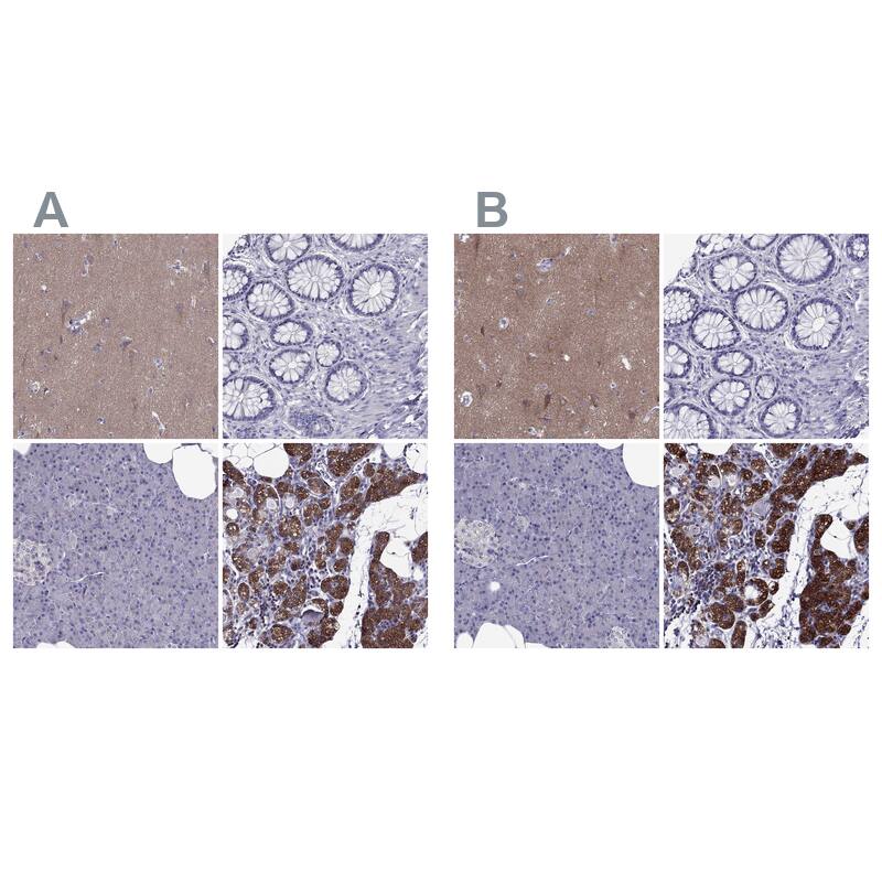 AAK1 Antibody - BSA Free Immunohistochemistry-Paraffin: AAK1 Antibody - BSA Free [NBP1-84111]