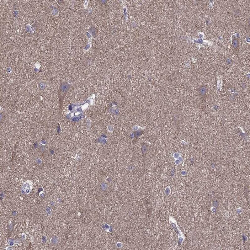 AAK1 Antibody - BSA Free Immunohistochemistry-Paraffin: AAK1 Antibody - BSA Free [NBP1-84111]