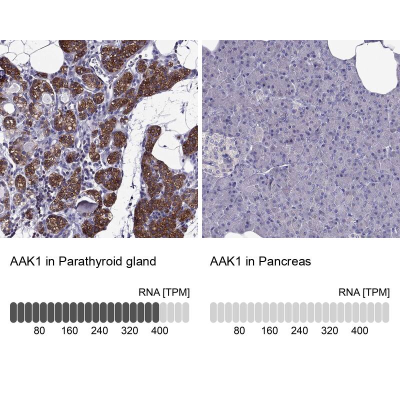 AAK1 Antibody - BSA Free Immunohistochemistry-Paraffin: AAK1 Antibody - BSA Free [NBP1-84111]