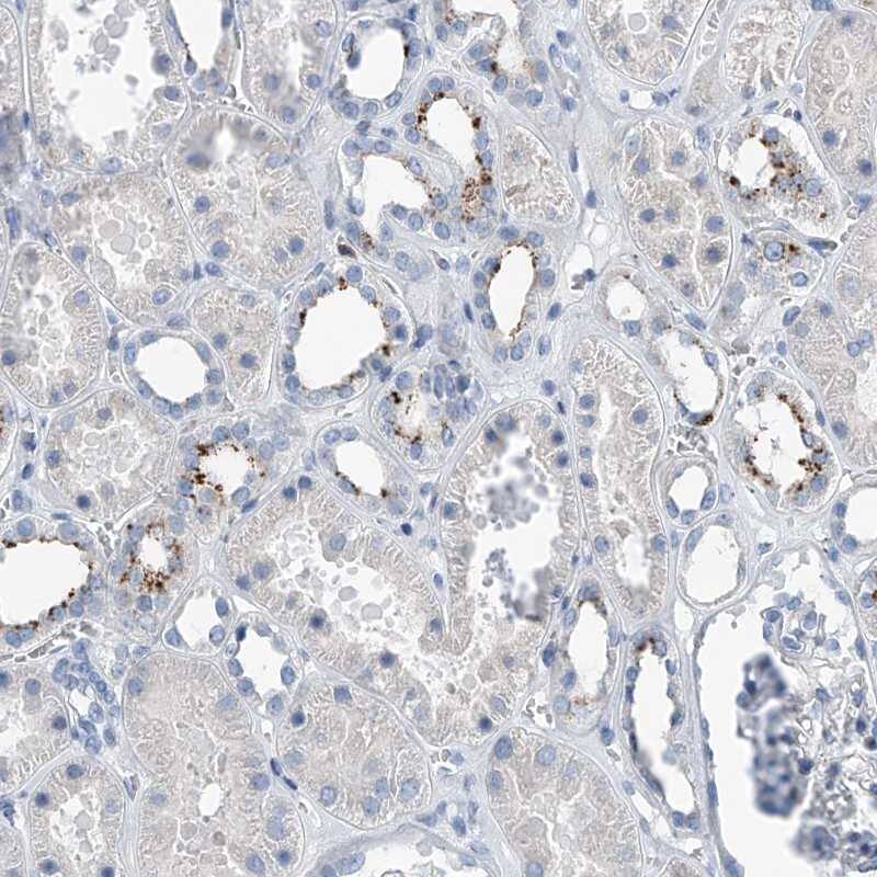 Zinc finger protein 772 Antibody - BSA Free Immunohistochemistry-Paraffin: Zinc finger protein 772 Antibody [NBP1-84113]