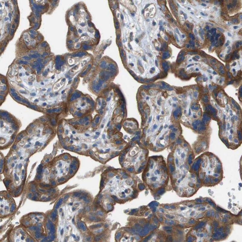 NRK Antibody - BSA Free Immunohistochemistry-Paraffin: NRK Antibody - BSA Free [NBP1-84121]