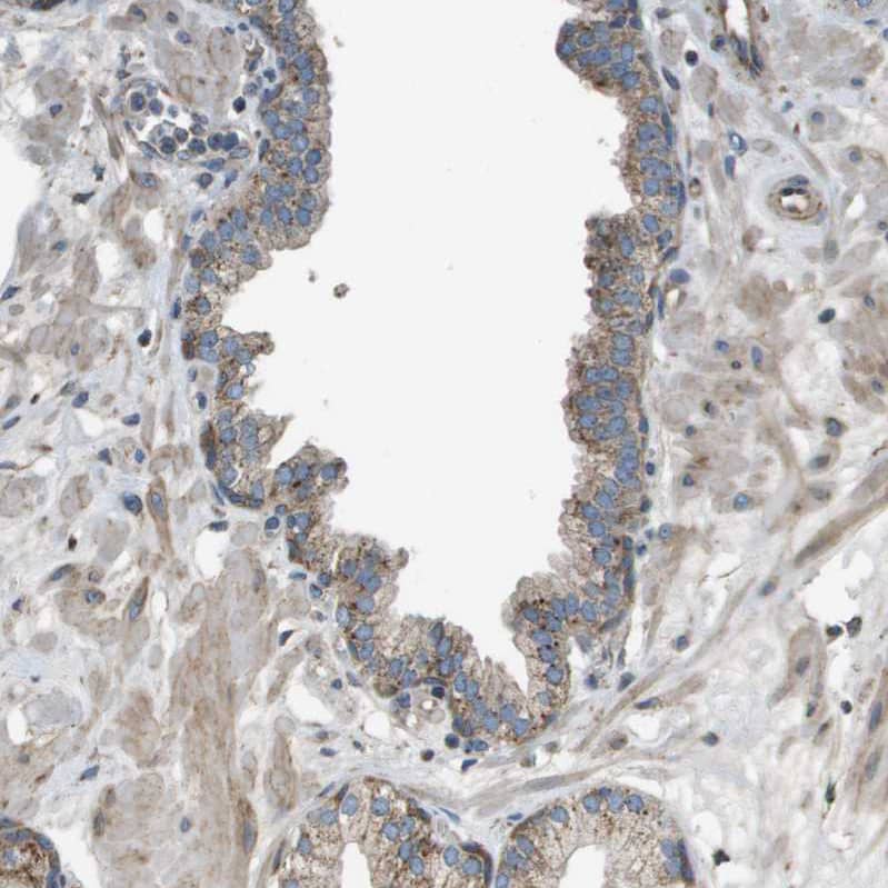NRK Antibody - BSA Free Immunohistochemistry-Paraffin: NRK Antibody - BSA Free [NBP1-84121]