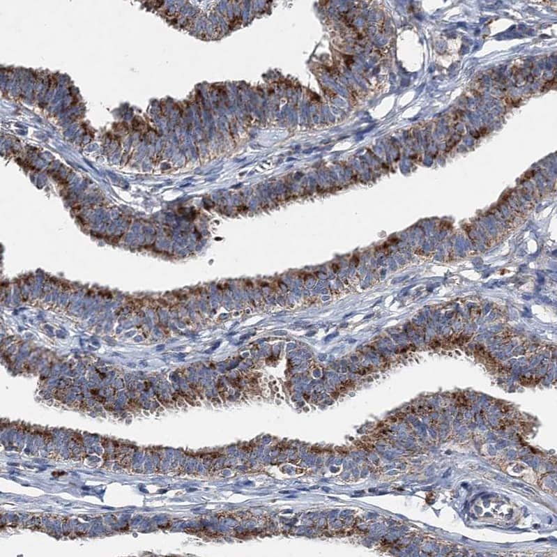 SPAG16 Antibody - BSA Free Immunohistochemistry-Paraffin: SPAG16 Antibody - BSA Free [NBP1-84124]