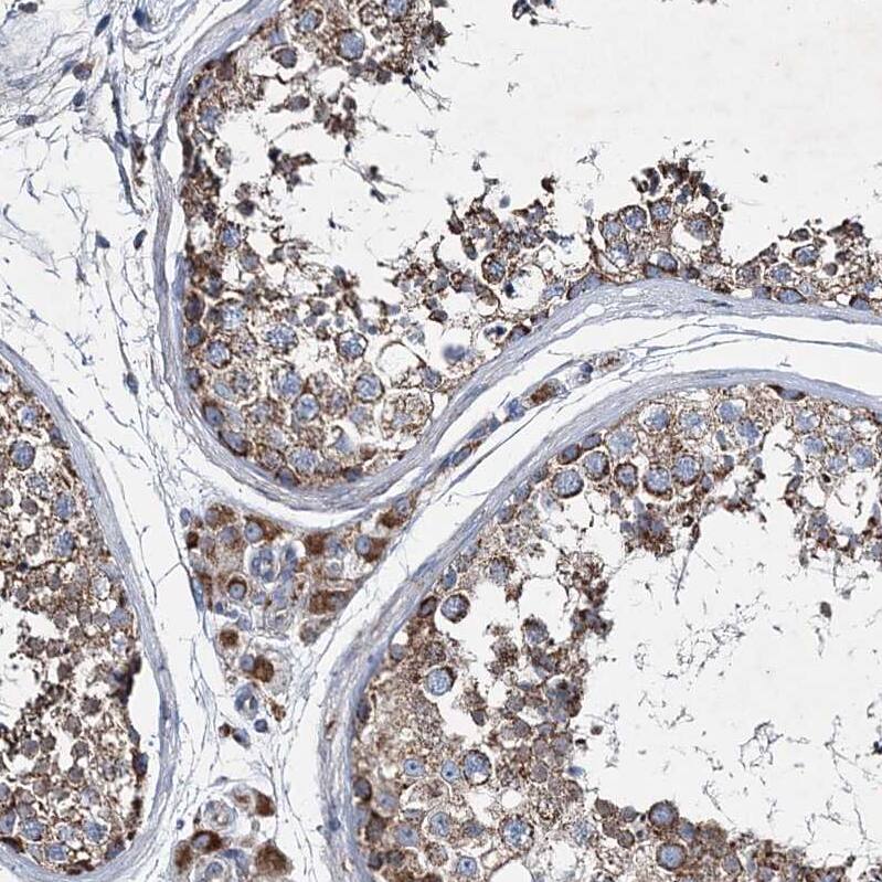 SPAG16 Antibody - BSA Free Immunohistochemistry-Paraffin: SPAG16 Antibody - BSA Free [NBP1-84124]