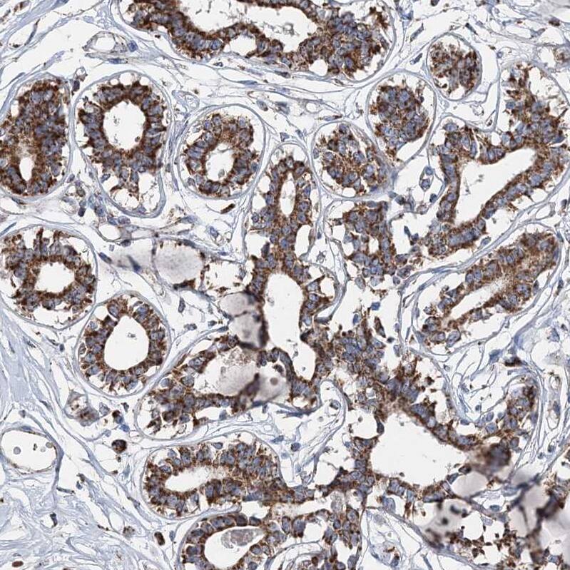 SPAG16 Antibody - BSA Free Immunohistochemistry-Paraffin: SPAG16 Antibody - BSA Free [NBP1-84124]