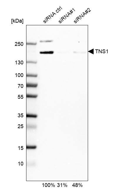 Tensin 1 Antibody - BSA Free Western Blot: Tensin 1 Antibody - BSA Free [NBP1-84130]