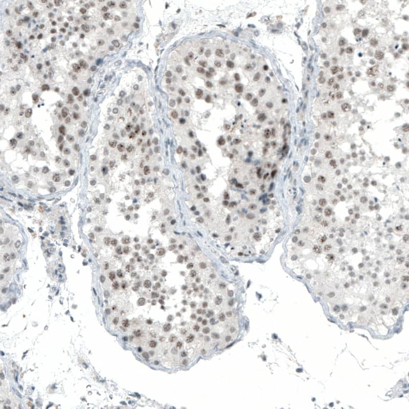 MED20 Antibody - BSA Free Immunohistochemistry-Paraffin: MED20 Antibody [NBP1-84140]
