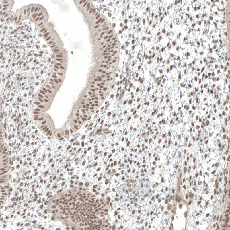 MED20 Antibody - BSA Free Immunohistochemistry-Paraffin: MED20 Antibody [NBP1-84140]