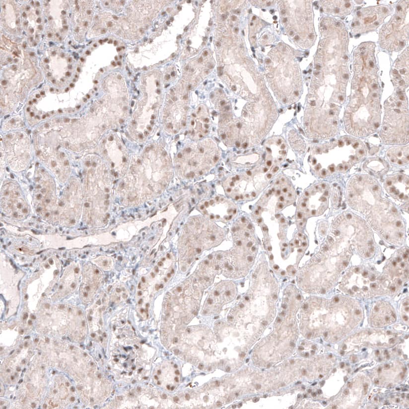 MED20 Antibody - BSA Free Immunohistochemistry-Paraffin: MED20 Antibody [NBP1-84140]