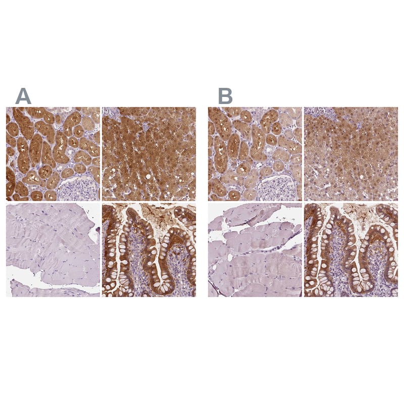 DAK Antibody - BSA Free Immunohistochemistry-Paraffin: DAK Antibody - BSA Free [NBP1-84142]