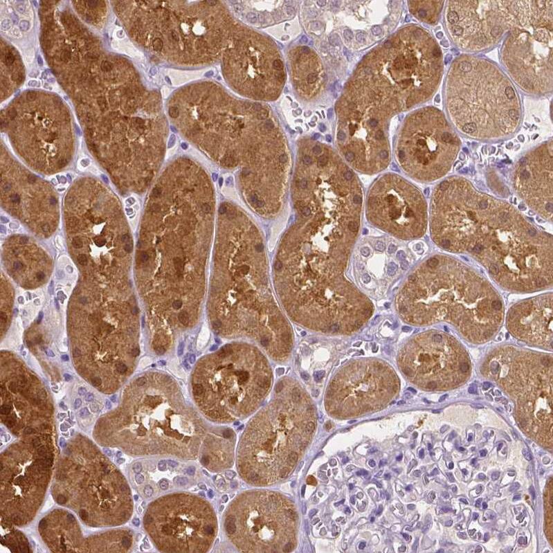 DAK Antibody - BSA Free Immunohistochemistry-Paraffin: DAK Antibody - BSA Free [NBP1-84142]